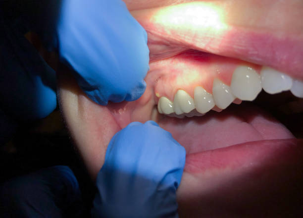 Best After-Hours Emergency Dentist in Weston Lakes, TX